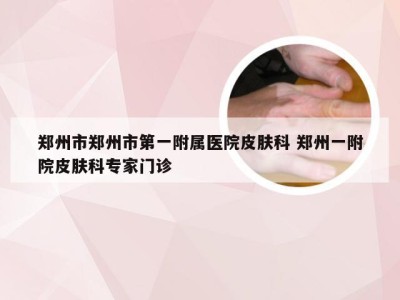 郑州市郑州市第一附属医院皮肤科 郑州一附院皮肤科专家门诊