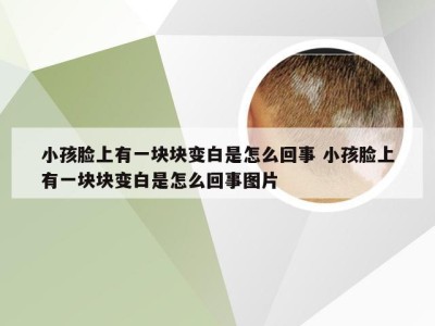 小孩脸上有一块块变白是怎么回事 小孩脸上有一块块变白是怎么回事图片