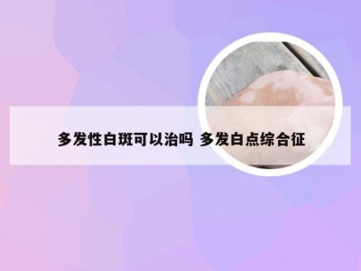 多发性白斑可以治吗 多发白点综合征