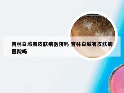 吉林白城有皮肤病医院吗 吉林白城有皮肤病医院吗