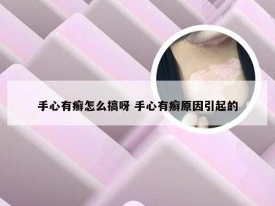 手心有癣怎么搞呀 手心有癣原因引起的