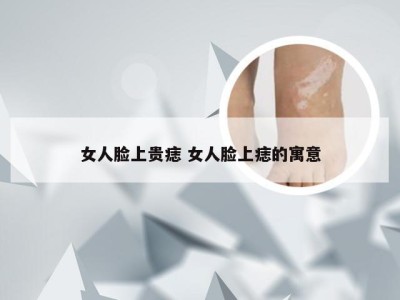 女人脸上贵痣 女人脸上痣的寓意