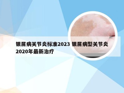 银屑病关节炎标准2023 银屑病型关节炎2020年最新治疗