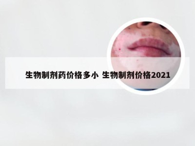 生物制剂药价格多小 生物制剂价格2021