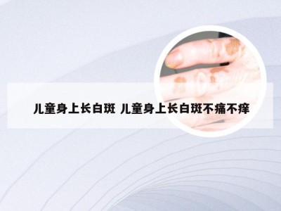 儿童身上长白斑 儿童身上长白斑不痛不痒