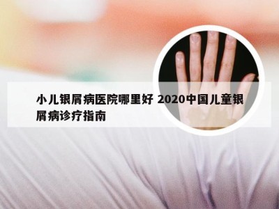 小儿银屑病医院哪里好 2020中国儿童银屑病诊疗指南