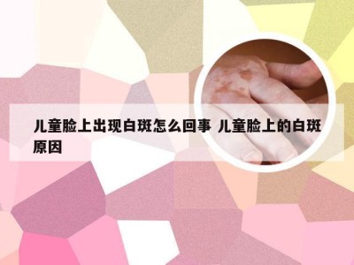 儿童脸上出现白斑怎么回事 儿童脸上的白斑原因