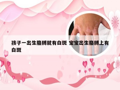 孩子一出生胳膊就有白斑 宝宝出生胳膊上有白斑