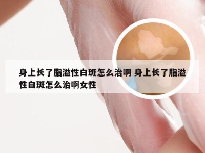 身上长了脂溢性白斑怎么治啊 身上长了脂溢性白斑怎么治啊女性