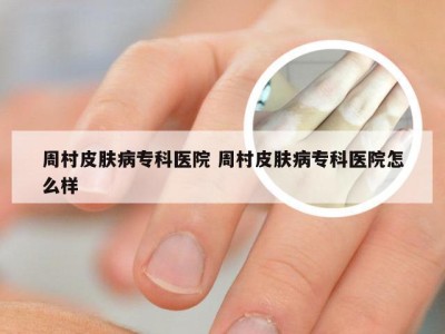 周村皮肤病专科医院 周村皮肤病专科医院怎么样