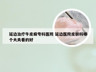 延边治疗牛皮癣专科医院 延边医院皮肤科哪个大夫看的好