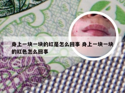 身上一块一块的红是怎么回事 身上一块一块的红色怎么回事