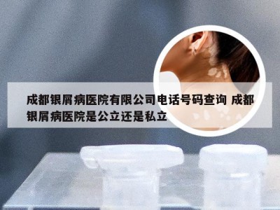 成都银屑病医院有限公司电话号码查询 成都银屑病医院是公立还是私立