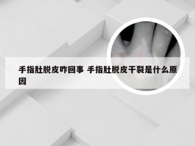 手指肚脱皮咋回事 手指肚脱皮干裂是什么原因