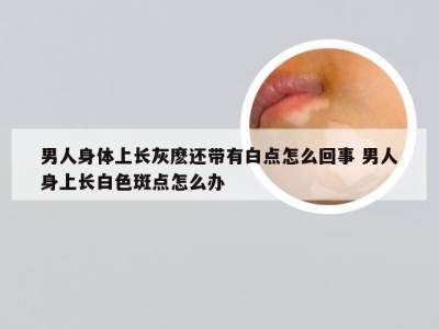 男人身体上长灰麽还带有白点怎么回事 男人身上长白色斑点怎么办