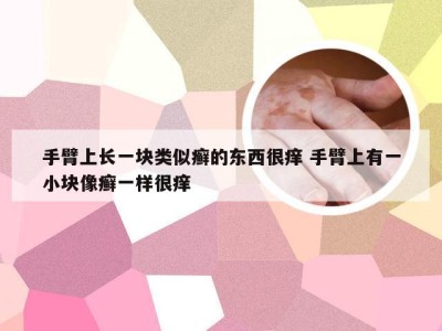 手臂上长一块类似癣的东西很痒 手臂上有一小块像癣一样很痒