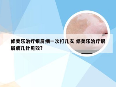 修美乐治疗银屑病一次打几支 修美乐治疗银屑病几针见效?