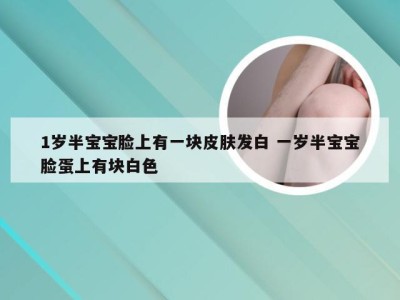 1岁半宝宝脸上有一块皮肤发白 一岁半宝宝脸蛋上有块白色