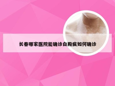 长春哪家医院能确诊白殿疯如何确诊