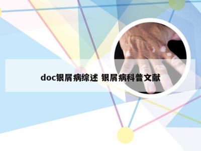 doc银屑病综述 银屑病科普文献