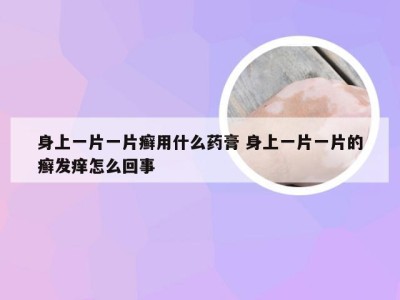 身上一片一片癣用什么药膏 身上一片一片的癣发痒怎么回事