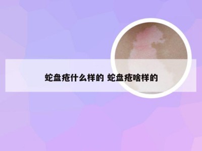 蛇盘疮什么样的 蛇盘疮啥样的