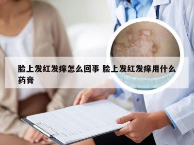 脸上发红发痒怎么回事 脸上发红发痒用什么药膏