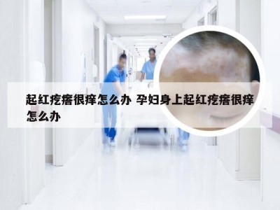 起红疙瘩很痒怎么办 孕妇身上起红疙瘩很痒怎么办