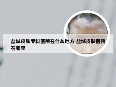 盐城皮肤专科医院在什么地方 盐城皮肤医院在哪里