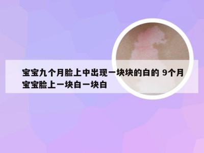 宝宝九个月脸上中出现一块块的白的 9个月宝宝脸上一块白一块白