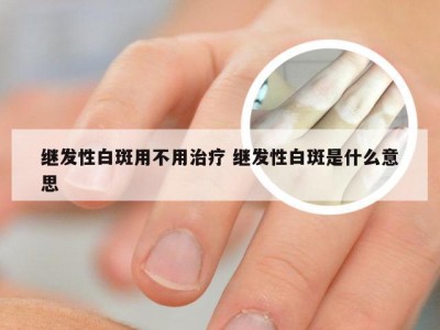 继发性白斑用不用治疗 继发性白斑是什么意思