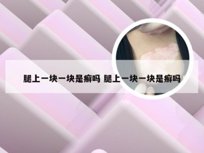 腿上一块一块是癣吗 腿上一块一块是癣吗