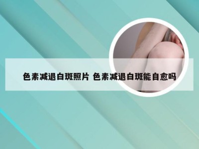 色素减退白斑照片 色素减退白斑能自愈吗