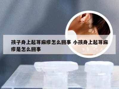 孩子身上起荨麻疹怎么回事 小孩身上起荨麻疹是怎么回事