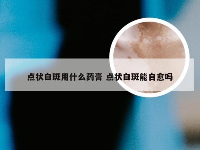 点状白斑用什么药膏 点状白斑能自愈吗