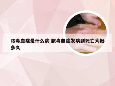 脓毒血症是什么病 脓毒血症发病到死亡大概多久