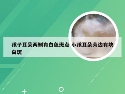 孩子耳朵两侧有白色斑点 小孩耳朵旁边有块白斑