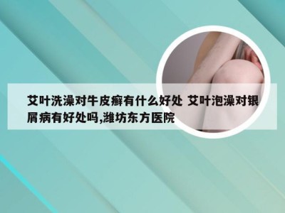 艾叶洗澡对牛皮癣有什么好处 艾叶泡澡对银屑病有好处吗,潍坊东方医院