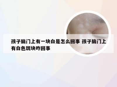 孩子脑门上有一块白是怎么回事 孩子脑门上有白色斑块咋回事