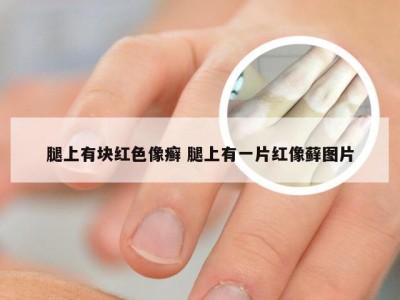 腿上有块红色像癣 腿上有一片红像藓图片