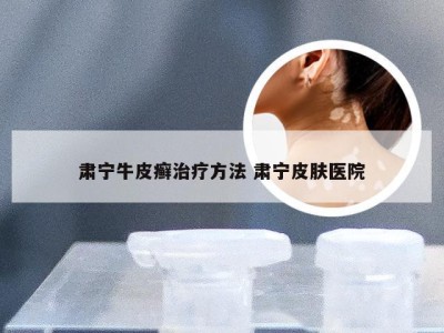 肃宁牛皮癣治疗方法 肃宁皮肤医院