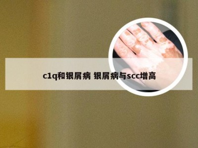 c1q和银屑病 银屑病与scc增高