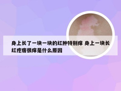 身上长了一块一块的红肿特别痒 身上一块长红疙瘩很痒是什么原因