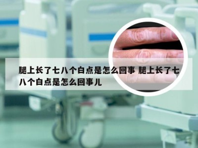 腿上长了七八个白点是怎么回事 腿上长了七八个白点是怎么回事儿