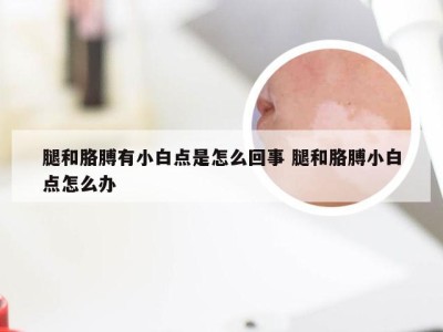 腿和胳膊有小白点是怎么回事 腿和胳膊小白点怎么办