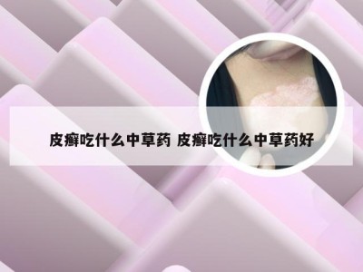 皮癣吃什么中草药 皮癣吃什么中草药好