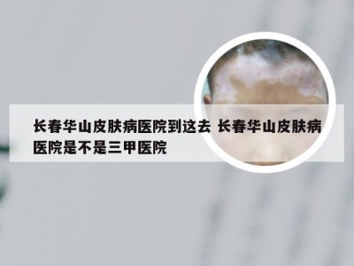 长春华山皮肤病医院到这去 长春华山皮肤病医院是不是三甲医院