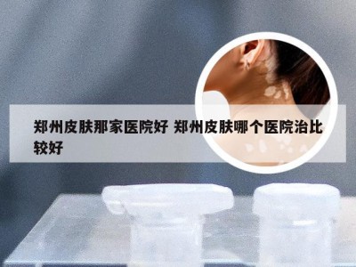 郑州皮肤那家医院好 郑州皮肤哪个医院治比较好