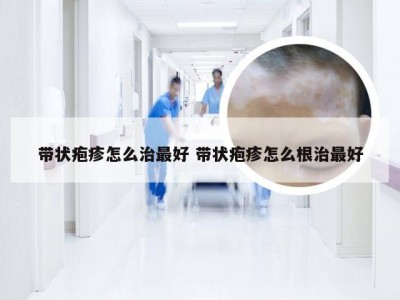 带状疱疹怎么治最好 带状疱疹怎么根治最好