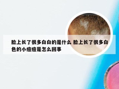 脸上长了很多白白的是什么 脸上长了很多白色的小痘痘是怎么回事